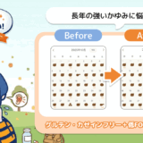 「あなたのウンログ見せてください」vol.12！“引き算の考え方”で花粉症改善した方