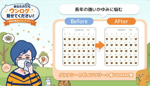 「あなたのウンログ見せてください」vol.12！“引き算の考え方”で花粉症改善した方